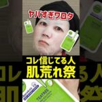 【ニキビが治る？】スキンケアに使うコスメにそんな効果はないぜ。